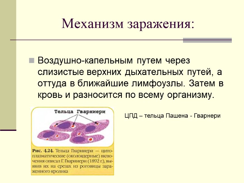 Механизм заражения: Воздушно-капельным путем через слизистые верхних дыхательных путей, а оттуда в ближайшие лимфоузлы.